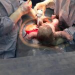 Jak wygląda cesarskie cięcie – krok po kroku w Polsce 236