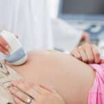 Fazy przedporodowe i ich wpływ na poród 576