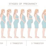 Faza przejściowa porodu i jej kluczowe znaczenie 982