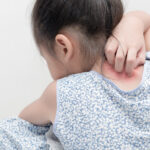 Świerzb u dzieci - co warto wiedzieć? Świerzb u dzieci - co warto wiedzieć?