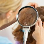 Kompendium wiedzy o wszawicy: objawy, diagnoza i skuteczne leczenie u dzieci leczenie-wszawicy2