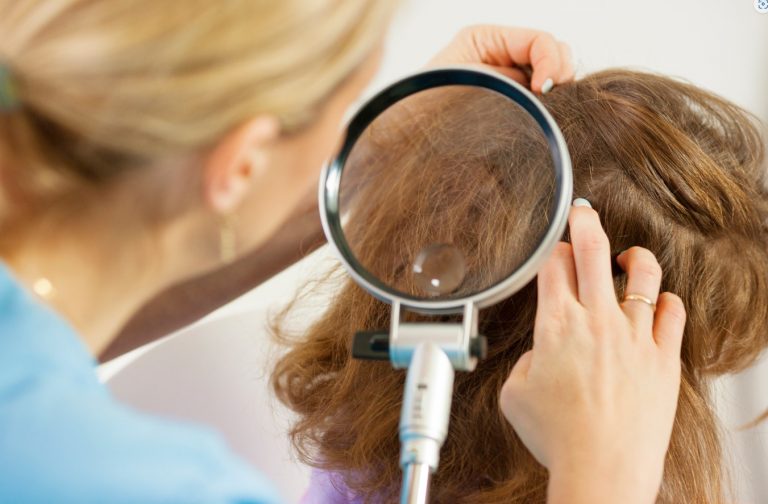 Kompendium wiedzy o wszawicy: objawy, diagnoza i skuteczne leczenie u dzieci